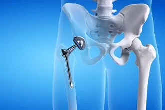 Sports Injuries: Types, Symptoms, Causes & Treatment