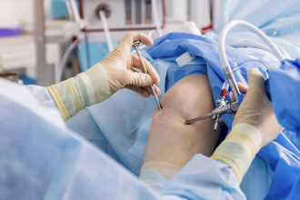What to Expect During Knee Arthroscopy Surgery